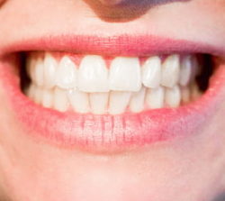 Beautify Your Smile - Birkitt Dental
